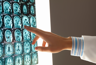 The hidden symptoms of a brain injury