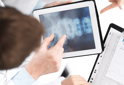 A doctor looks at a spinal x-ray on a tablet