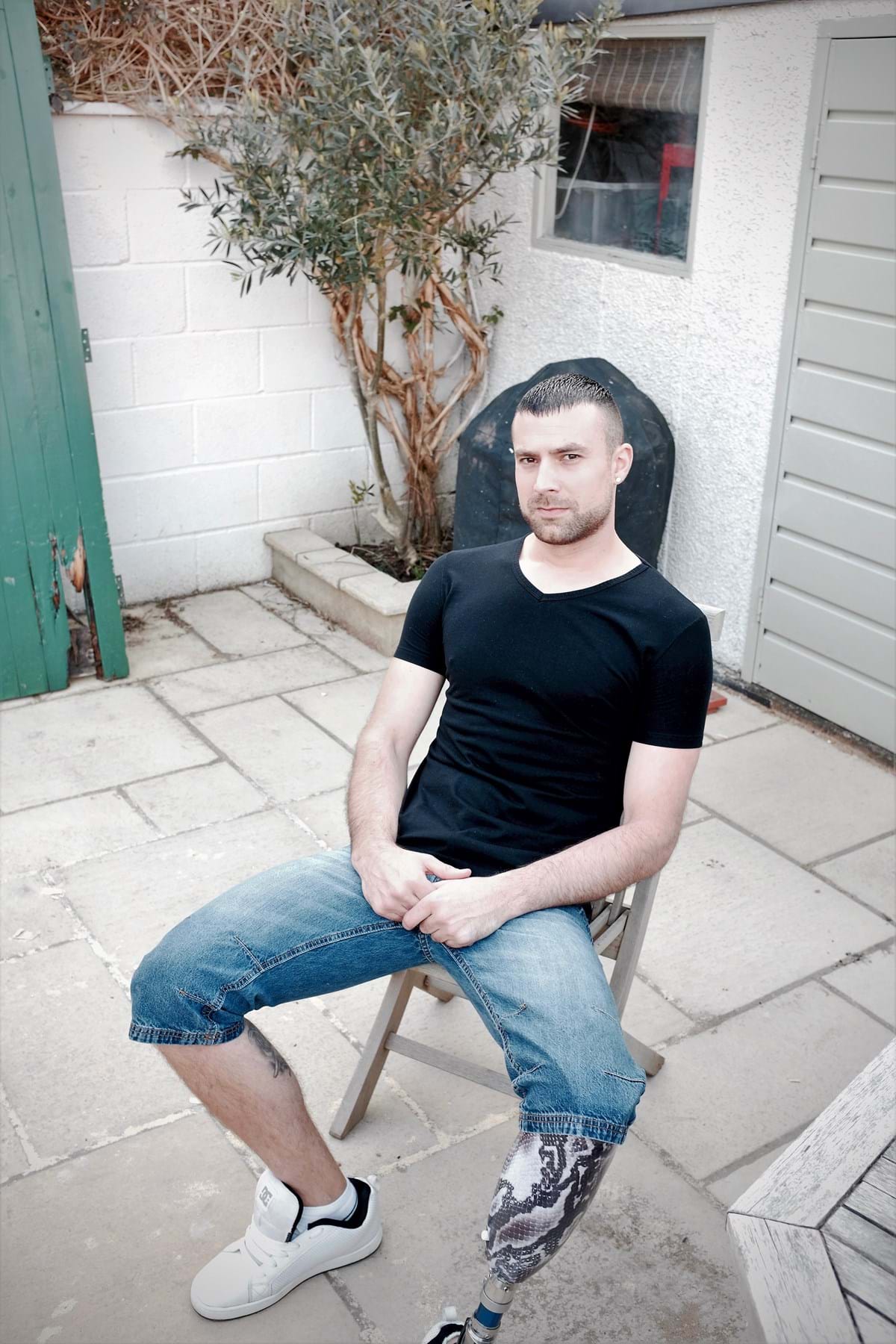 James Redwood, amputation client