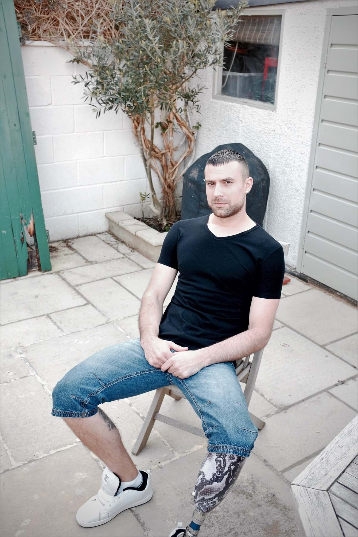 James Redwood, amputation client