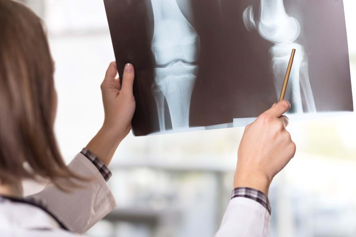 A doctor inspects an x-ray of a patient