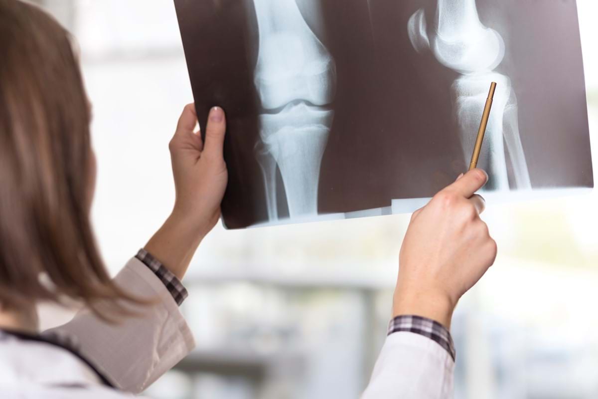 A doctor inspects an x-ray of a patient