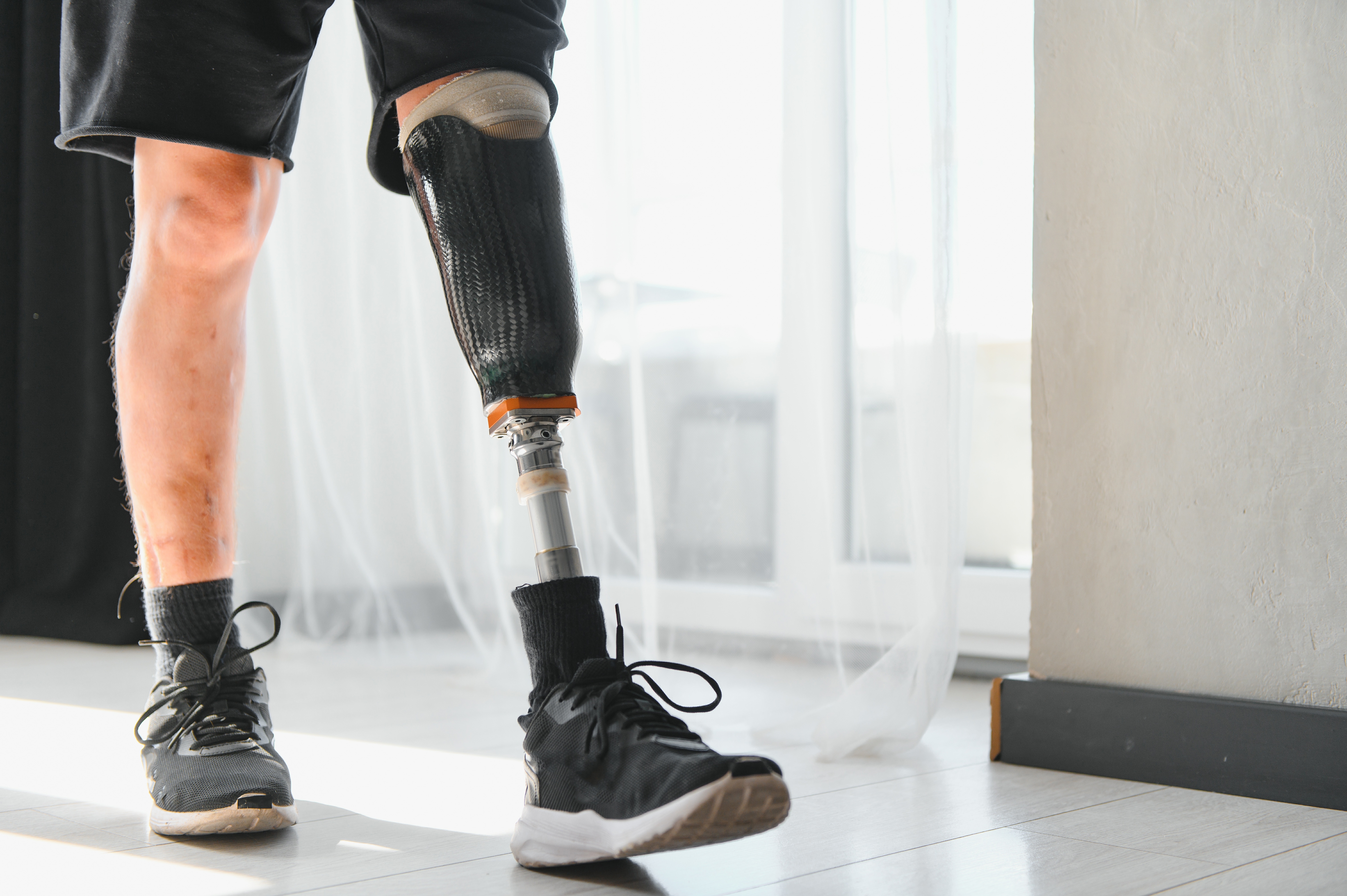 Foot Amputation Following Injury: Impact, Recovery and Compensation