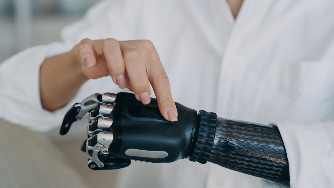 Prosthetic Limbs: What to Expect, What’s Possible, and What Do They Cost